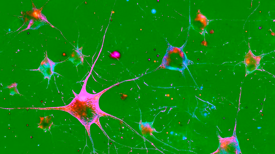 神经网络核心内功：从感知机到训练稳定的深度模型